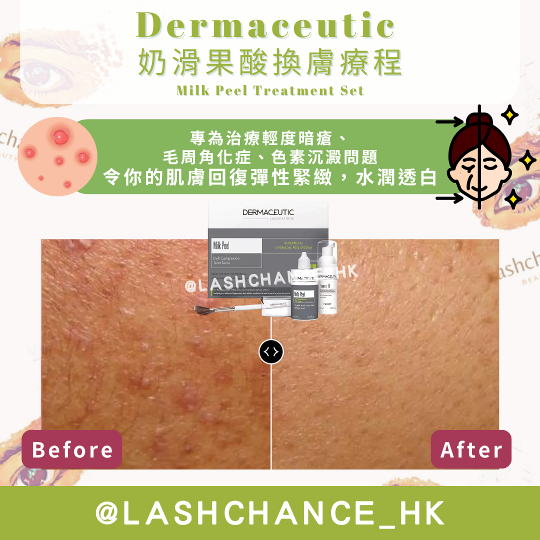 Dermaceutic 牛奶酸換膚療程 Milk Peel Treatment Set