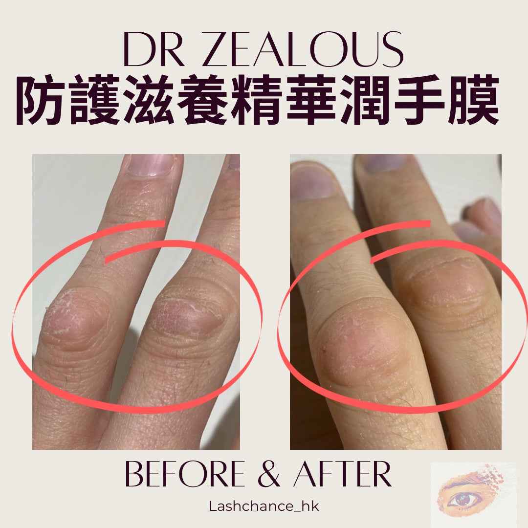Dr. Zealous 防護滋養精華潤手膜 5對