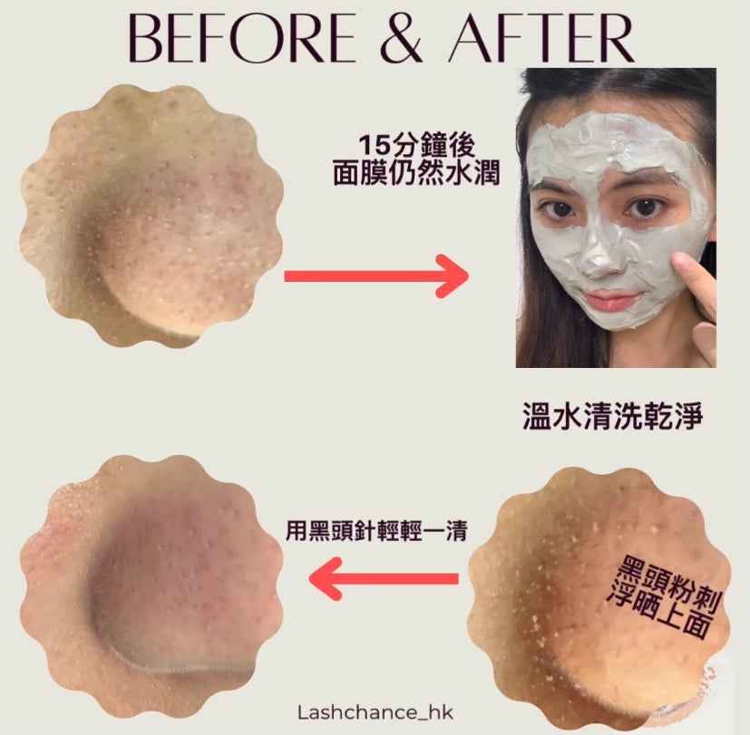 Bio~C~Ziwi 法國詩華 火山泥戰豆暗瘡面膜