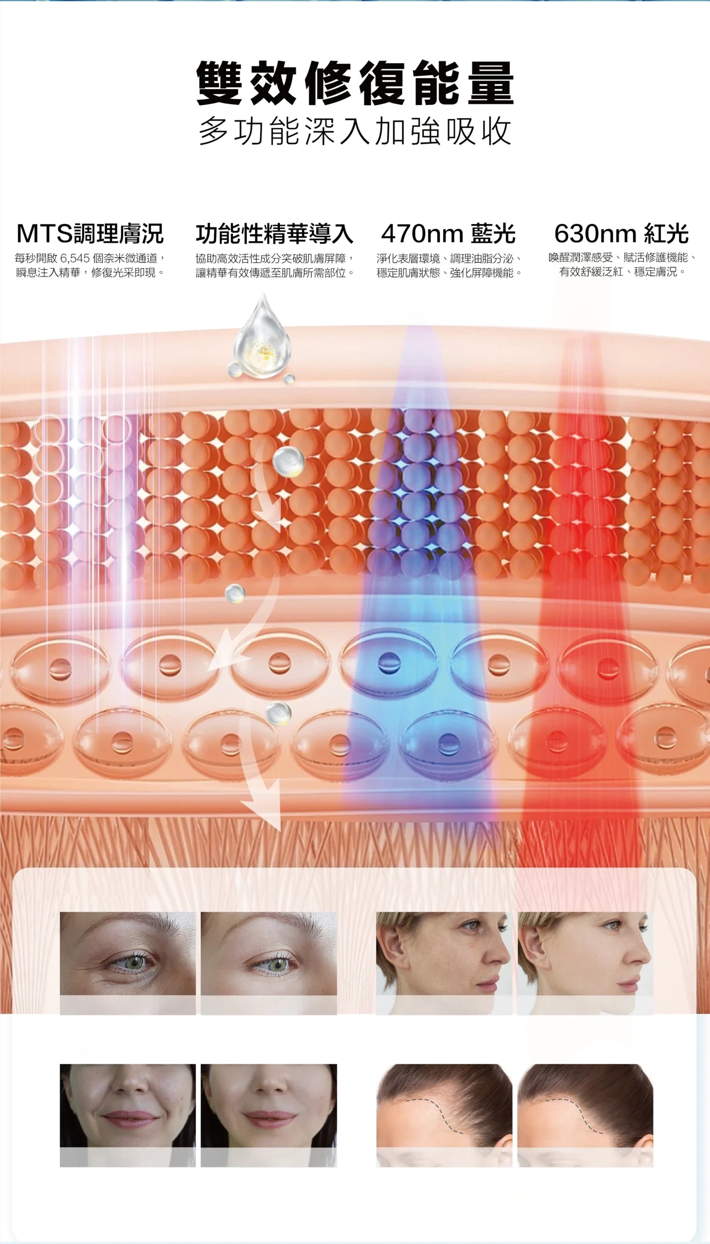 Hydra Pen H6 家用電動微針機